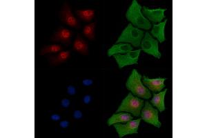 ABIN6258022 and ABIN6273585 staining Hela cells by IF/ICC.
