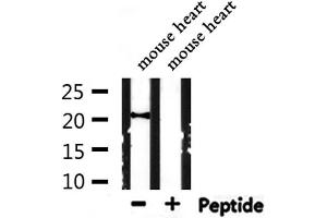 Western blot analysis of extracts from mouse heart, using ARF6 Antibody.