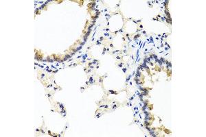 Immunohistochemistry of paraffin-embedded rat lung using IFNL1 antibody at dilution of 1:100 (40x lens). (IL29 antibody)