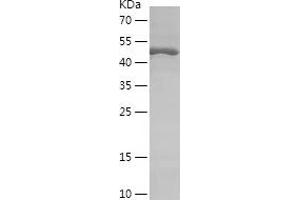 Western Blotting (WB) image for Ribosomal Protein S6 Kinase, 70kDa, Polypeptide 1 (RPS6KB1) (AA 51-300) protein (His-IF2DI Tag) (ABIN7284047) (RPS6KB1 Protein (AA 51-300) (His-IF2DI Tag))