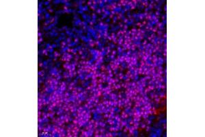 Immunofluorescence of paraffin embedded rat thymus using TCF7 (ABIN7075952) at dilution of 1:600 (400x lens) (TCF7 antibody)