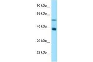 Image no. 1 for anti-Tripartite Motif Containing 7 (TRIM7) (AA 52-101) antibody (ABIN6748140) (TRIM7 antibody  (AA 52-101))