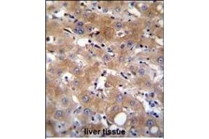 TR Antibody (Center) (ABIN655714 and ABIN2845164) immunohistochemistry analysis in formalin fixed and paraffin embedded human liver tissue followed by peroxidase conjugation of the secondary antibody and DAB staining.