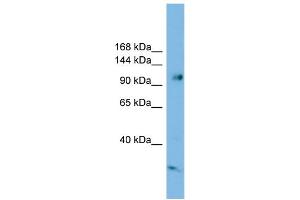 WB Suggested Anti-SMEK1 Antibody Titration: 0. (SMEK1 antibody  (Middle Region))
