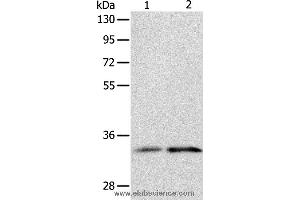 Western blot analysis of Human fetal kidney and intestine tissue, using IL1RL1 Polyclonal Antibody at dilution of 1:1100 (IL1RL1 antibody)