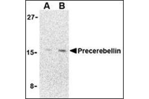 Western blot analysis of precerebellin in 293 cell lysate with precerebellin AP30690PU-N at (A) 2 and (B) 4 μg/ml.