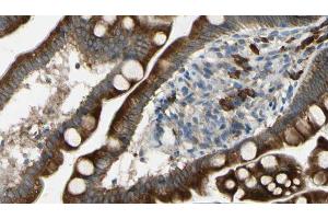 ABIN6267436 at 1/100 staining Mouse intestine tissue by IHC-P. (CBL antibody  (pTyr674))