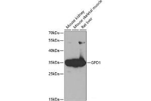 Western blot analysis of extracts of various cell lines using GPD1 Polyclonal Antibody at dilution of 1:1000. (GPD1 antibody)