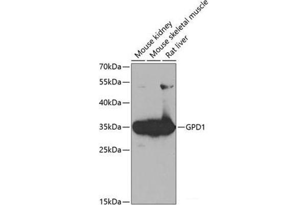 GPD1 抗体