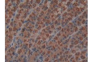 DAB staining on IHC-P; Samples: Rat Stomach Tissue (MIA antibody  (AA 36-127))