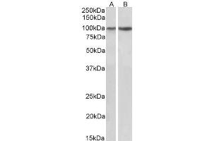 ABIN5539639 (1µg/ml) staining of Human (A) and Mouse (B) Heart lysates (35µg protein in RIPA buffer). (ITGA3 antibody  (C-Term))