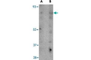 Western blot analysis of SCARB2 in human skeletal muscle tissue lysate with SCARB2 polyclonal antibody  at (A) 1 and (B) 2 ug/mL . (SCARB2 antibody  (C-Term))