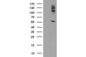 HEK293T cells were transfected with the pCMV6-ENTRY control (Left lane) or pCMV6-ENTRY LIPG (Right lane) cDNA for 48 hrs and lysed. (LIPG antibody)