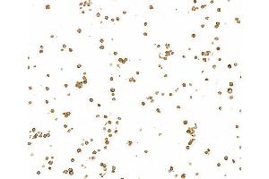 Immunocytochemistry (ICC) image for anti-B-cell antigen receptor complex-associated protein alpha chain (CD79A) (AA 33-143) antibody (ABIN7453962) (Recombinant CD79a antibody  (AA 33-143))