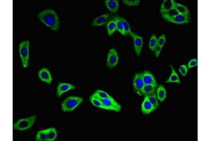 Immunofluorescent analysis of HepG2 cells using ABIN7173163 at dilution of 1:100 and Alexa Fluor 488-congugated AffiniPure Goat Anti-Rabbit IgG(H+L) (C2CD2L antibody  (AA 42-87))