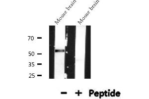 Western blot analysis of MeCP2 expression in Mouse brain lysate (MECP2 antibody  (N-Term))