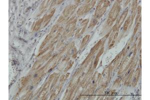 Immunoperoxidase of monoclonal antibody to PDHB on formalin-fixed paraffin-embedded human heart. (PDHB antibody  (AA 250-359))