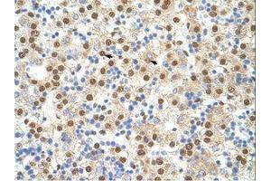 Image no. 3 for anti-Interleukin enhancer-binding factor 3 (ILF3) (AA 41-90) antibody (ABIN6736203) (Interleukin enhancer-binding factor 3 (ILF3) (AA 41-90) antibody)