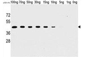 Western blot analysis of H1L antibody and recombinant H1L protein. (Tyr/ser Protein Phosphatase antibody)