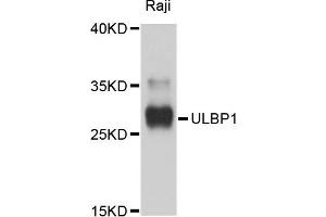 Western blot analysis of extracts of Raji cells, using ULBP1 antibody. (ULBP1 antibody)