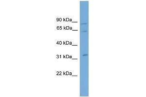WB Suggested Anti-CAPN11 Antibody Titration: 0. (CAPN11 antibody  (N-Term))