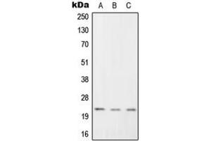 Western blot analysis of RGS1 expression in K562 (A), Raw264. (RGS1 antibody  (Center))