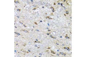 Immunohistochemistry of paraffin-embedded mouse spinal cord using BLZF1 antibody (ABIN5973830) at dilution of 1/100 (40x lens). (BLZF1 antibody)