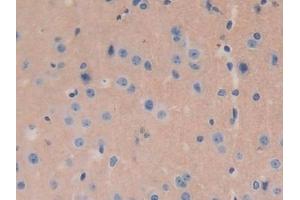 Immunohistochemistry (IHC) image for anti-Guanine Nucleotide Binding Protein (G Protein), gamma 8 (GNG8) (AA 1-70) antibody (ABIN7443329)