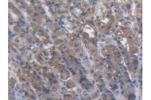 Detection of KTN1 in Rat Stomach Tissue using Polyclonal Antibody to Kinectin 1 (KTN1) (KTN1 antibody  (AA 1162-1325))