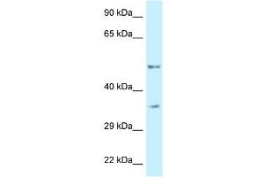 WB Suggested Anti-PFKFB1 Antibody Titration: 1.