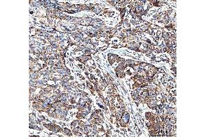 IHC analysis of MUT using anti-MUT antibody (ABIN4886676). (MUT antibody  (N-Term))