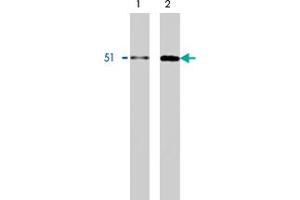 Western blot using HNRNPK monoclonal antibody, clone F45 P9 C7  on Calu-6 (1) and HT-29 (2) cell lysates.