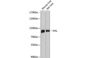 Western blot analysis of extracts of various cell lines, using HAL antibody (ABIN6130467, ABIN6141593, ABIN6141594 and ABIN6216851) at 1:3000 dilution. (HAL antibody  (AA 1-200))