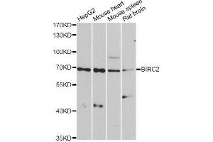 Western blot analysis of extracts of various cell lines, using BIRC2 antibody. (BIRC2 antibody  (AA 1-300))