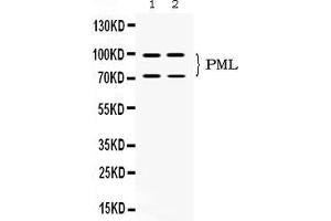 Western blot analysis of PML Protein expression in SW620 whole cell lysates ( Lane 1) and U2OS whole cell lysates ( Lane 2). (PML antibody  (N-Term))