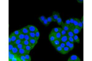 Immunofluorescence analysis of PC-12 cells using ARRB1 antibody (ABIN4903044). (beta Arrestin 1 antibody)