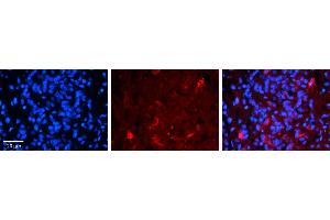 Rabbit Anti-FBXO9 Antibody     Formalin Fixed Paraffin Embedded Tissue: Human Pineal Tissue  Observed Staining: Cytoplasmic in cell bodies and processes of pinealocytes  Primary Antibody Concentration: 1:100  Other Working Concentrations: 1/600  Secondary Antibody: Donkey anti-Rabbit-Cy3  Secondary Antibody Concentration: 1:200  Magnification: 20X  Exposure Time: 0. (FBXO9 antibody  (Middle Region))