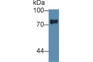 Detection of SCEL in Human Lung lysate using Polyclonal Antibody to Sciellin (SCEL) (SCEL antibody  (AA 519-685))