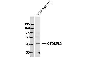 MDA-MB-231 lysates probed with CTDSPL2 Polyclonal Antibody, Unconjugated  at 1:300 dilution and 4˚C overnight incubation. (CTDSPL2 antibody  (AA 11-110))