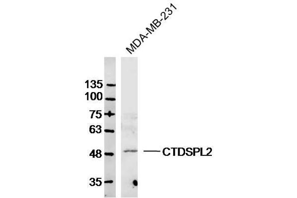 CTDSPL2 anticorps  (AA 11-110)