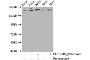 Western Blot Positive WB detected in Hela whole cell lysate,A549 whole cell lysate(treated with EGF or Pervanadate) All lanes Phospho-PDGFRB antibody at 1. (Recombinant PDGFRB antibody  (pTyr740))