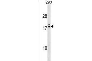 HIATL2 Antibody (N-term) (ABIN1538895 and ABIN2838153) western blot analysis in 293 cell line lysates (35 μg/lane). (HIATL2 antibody  (N-Term))