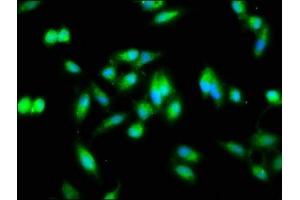 Immunofluorescence staining of Hela cells with ABIN7161777 at 1:133, counter-stained with DAPI. (NFKB2 antibody  (AA 263-439))