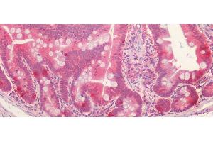 Detection of LOXL1 in Human Small Intestine Tissue using Polyclonal Antibody to Lysyl Oxidase Like Protein 1 (LOXL1) (LOXL1 antibody  (AA 369-574))