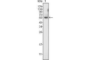 Western blot analysis using ETV4 mouse mAb against K562 cell lysate (1). (ETV4 antibody  (AA 50-109))