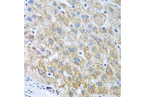 Immunohistochemistry of paraffin-embedded human liver using UBE2U antibody (ABIN5974574) at dilution of 1/100 (40x lens). (UBE2U antibody)