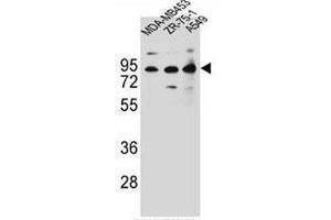 CTTNBP2NL Antibody (N-term) western blot analysis in MDA-MB453,ZR-75-1,A549 cell line lysates (35µg/lane).