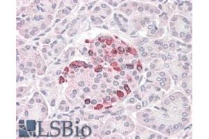 ABIN184705 (3. (SOCS4 antibody  (C-Term))