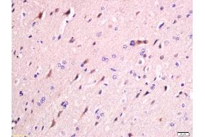 Formalin-fixed and paraffin embedded rat brain labeled with Anti-FAM134B Polyclonal Antibody, Unconjugated  at 1:200 followed by conjugation to the secondary antibody and DAB staining