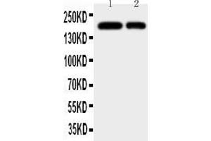 Anti-CD11b antibody, All Western blottingAll lanes: Anti-ITGAM at 0. (CD11b antibody  (N-Term))